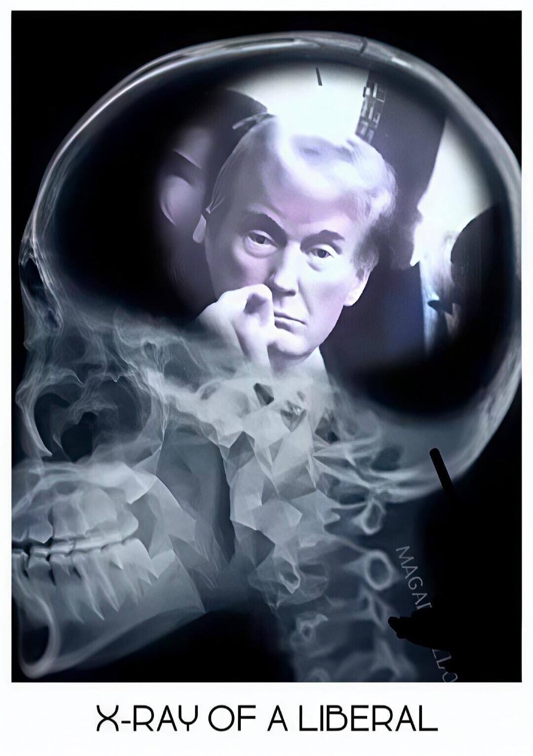 An X-ray image of a human skull with Donald Trump's face inside, accompanied by the text 