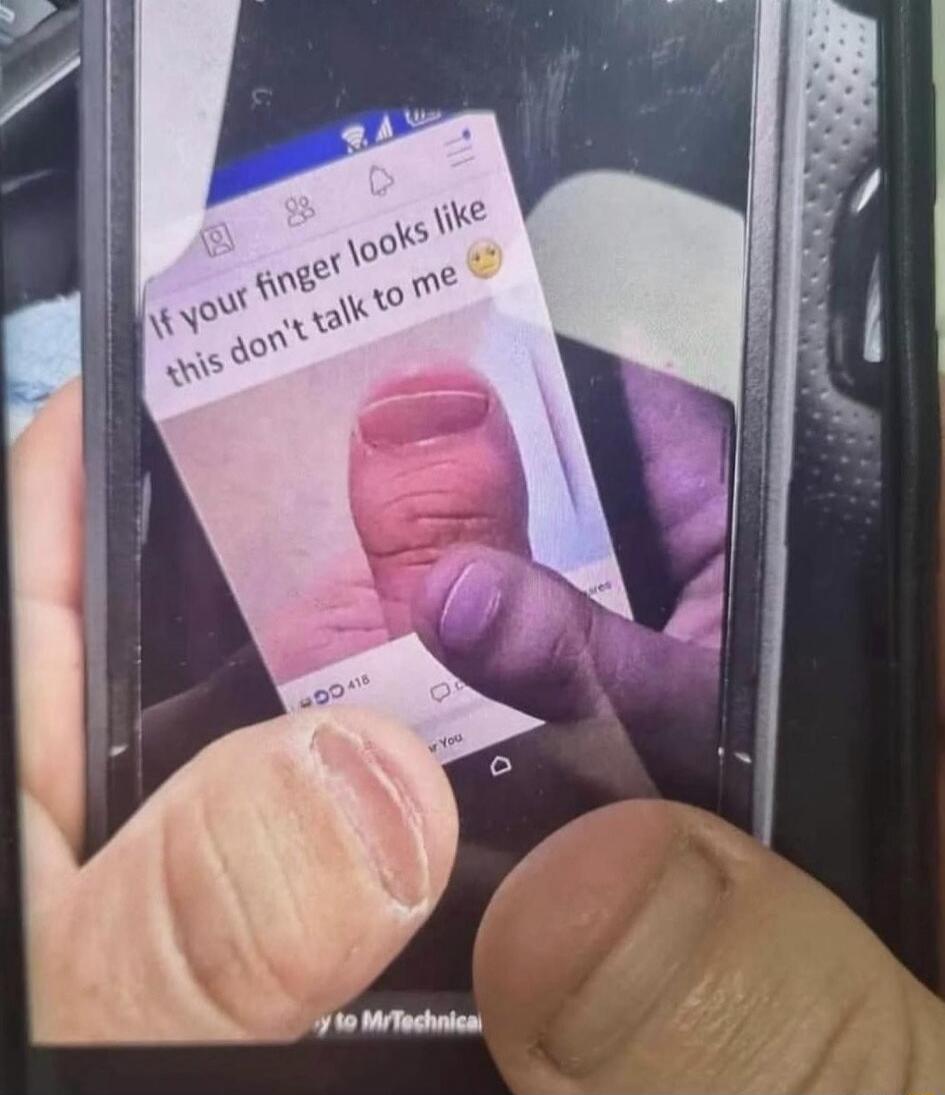 If your finger looks like this don't talk to me 🤨