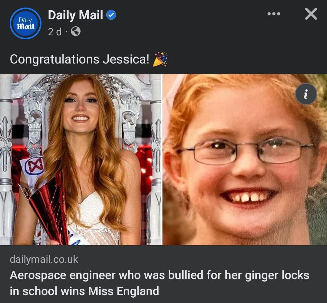 EAVETEY e X 2d Congratulations Jessica pese dailymailcouk Aerospace engineer who was bullied for her ginger locks in school wins Miss England You Miss England Contest and 82k others 22k comments 1k