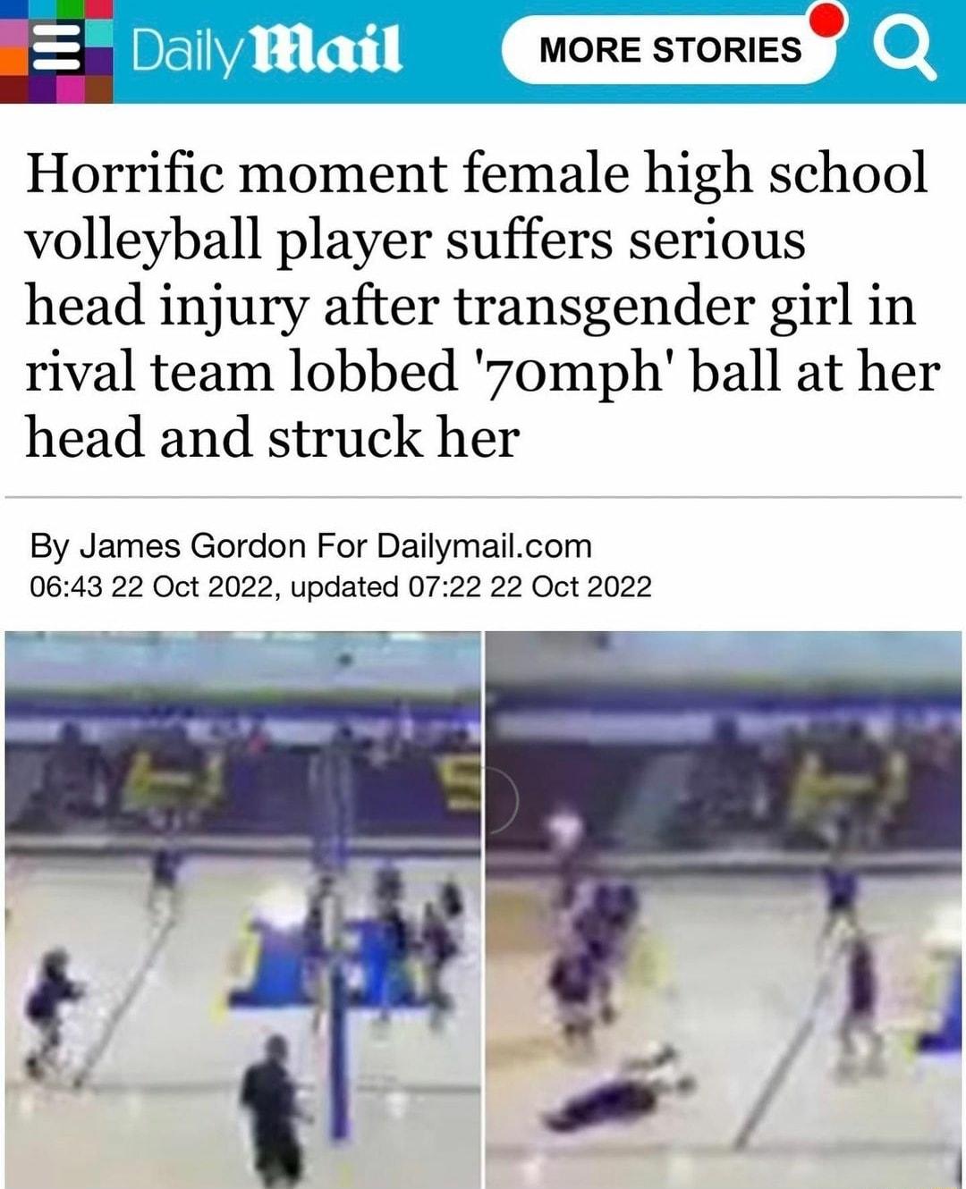 E MORE SYDRIES Horrific moment female high school volleyball player suffers serious head injury after transgender girl in rival team lobbed 7omph ball at her head and struck her By James Gordon For Dailymailcom 0643 22 Oct 2022 updated 0722 22 Oct 2022