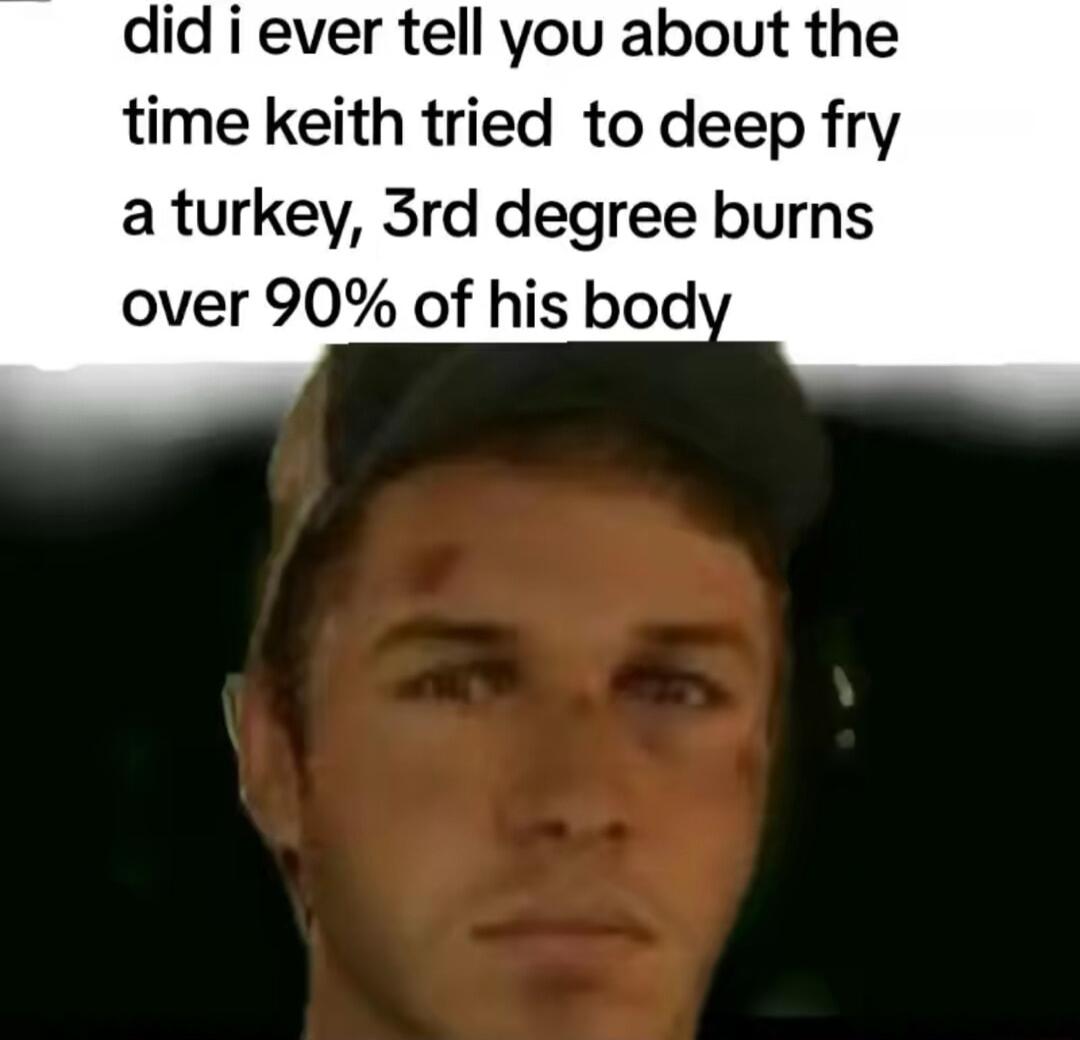did i ever tell you about the time keith tried to deep fry a turkey 3rd degree burns over 90 of his bod