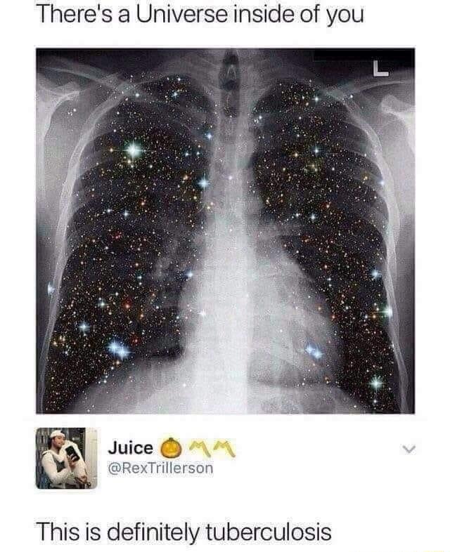 Theres a Universe inside of you Juice i RexTrillerson This is definitely tuberculosis