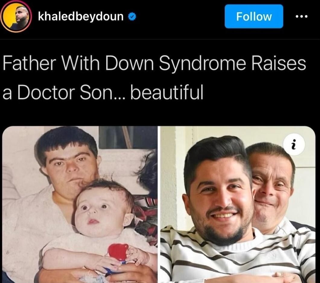 LUEIER LT R Father With Down Syndrome Raises a Doctor Son beautiful