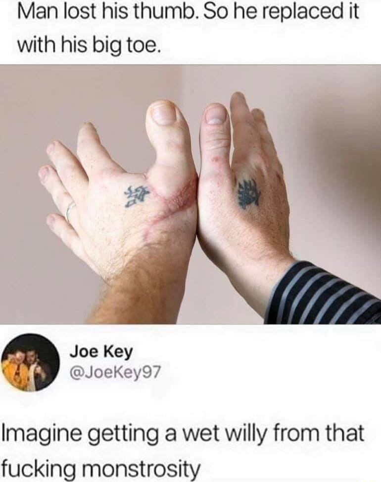 Man lost his thumb So he replaced it with his big toe Vg N Joe Key JoeKey97 Imagine getting a wet willy from that fucking monstrosity