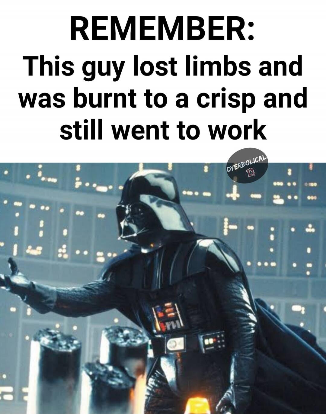 REMEMBER: This guy lost limbs and was burnt to a crisp and still went to work