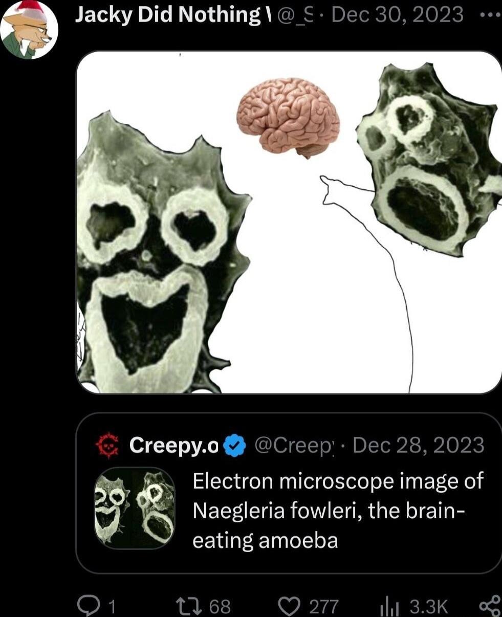 JE AT AN G A Creepy0 5 o Electron microscope image of 5 Naegleria fowleri the brain EENEE T S E