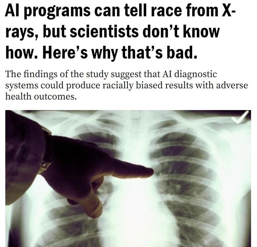 Al programs can tell race from X rays but scientists dont know how Heres why thats bad The findings of the study suggest that AI diagnostic systems could produce racially biased results with adverse health outcomes