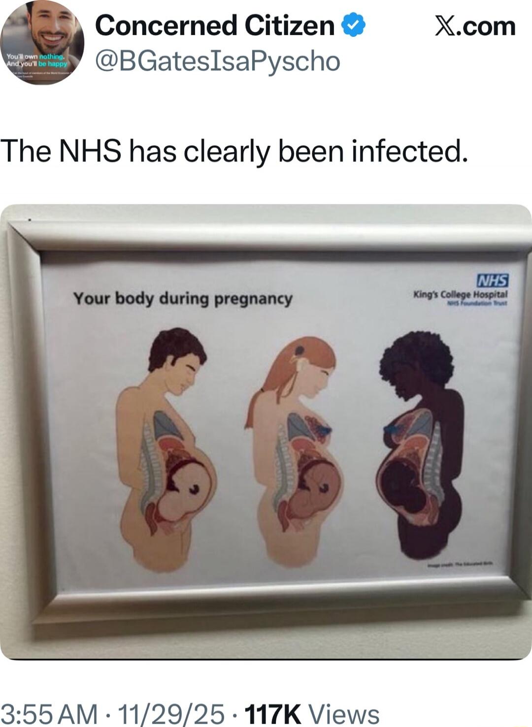 The NHS has clearly been infected.
Your body during pregnancy