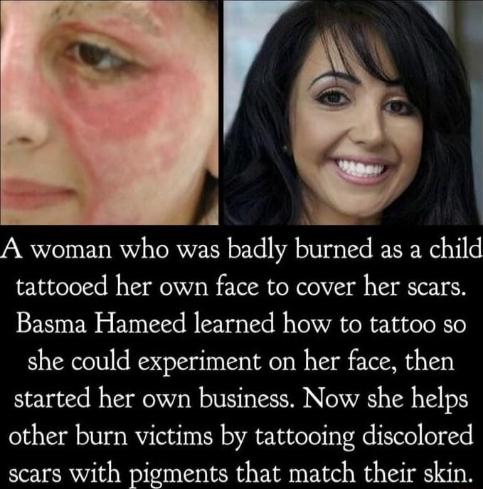 4 o A woman who was badly burned as a child tattooed her own face to cover her scars Basma Hameed learned how to tattoo so she could experiment on her face then started her own business Now she helps other burn victims by tattooing discolored scars with pigments that match their skin