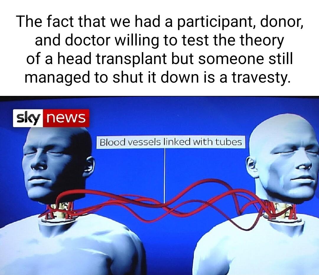 The fact that we had a participant donor and doctor willing to test the theory of a head transplant but someone still managed to shut it down is a travesty