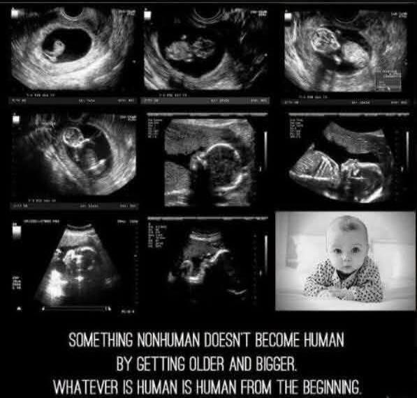 SOMETHING NONHUMAN DOESN'T BECOME HUMAN BY GETTING OLDER AND BIGGER. WHATEVER IS HUMAN IS HUMAN FROM THE BEGINNING.