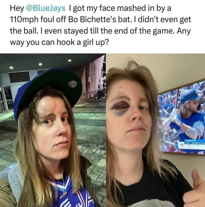 Hey Blue got my face mashed in by a 110mph foul off Bo Bichettes bat didnt even get the ball even stayed till the end of the game Any way you can hook a girl up