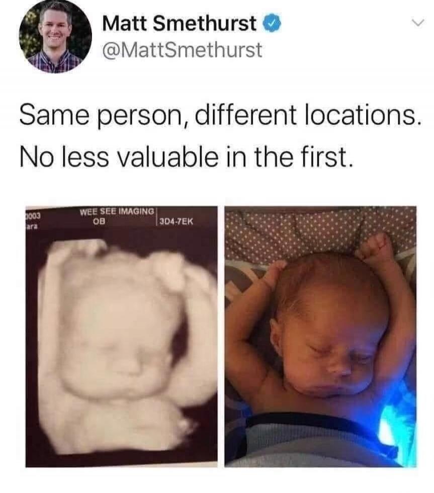 Matt Smethurst @MattSmethurst Same person, different locations. No less valuable in the first. WEE SEE IMAGING OB 3D4-7EK