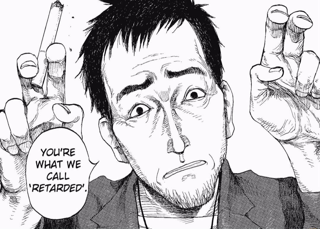 YOLRE WHAT WE CALL RETARDED