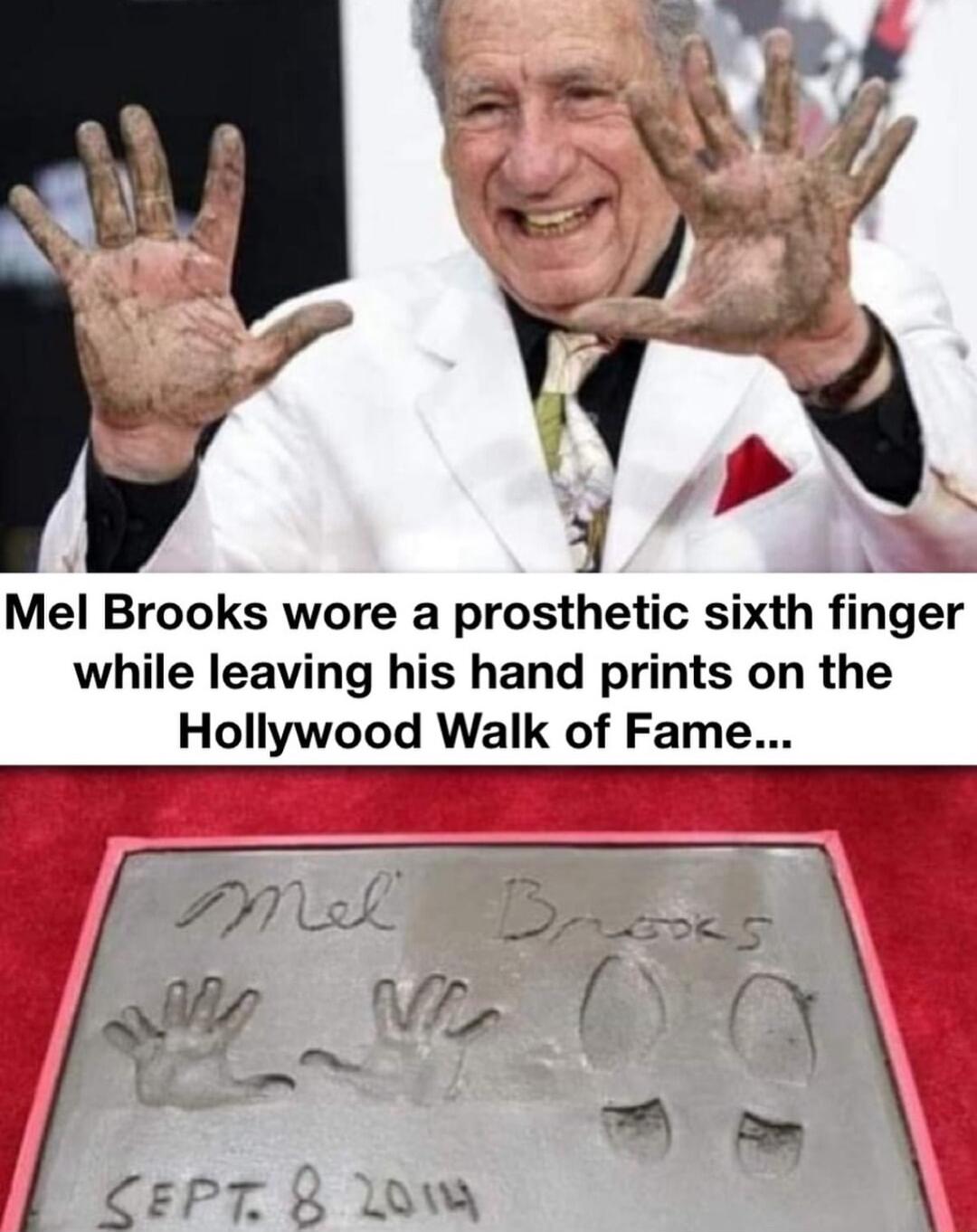 Mel Brooks wore a prosthetic sixth fmger while leaving his hand prints on the Hollywood Walk of Fame