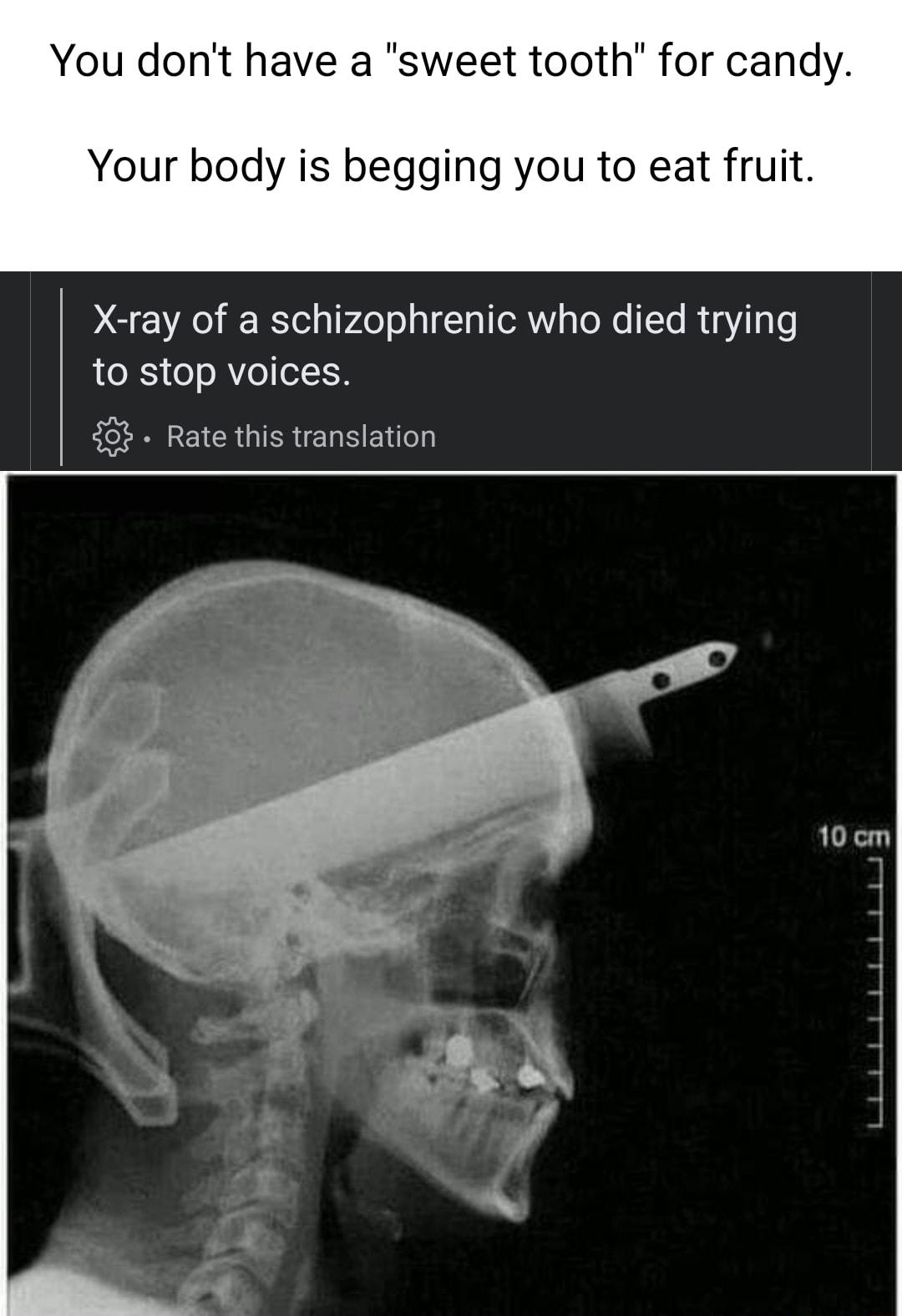 You dont have a sweet tooth for candy Your body is begging you to eat fruit X ray of a schizophrenic who died trying to stop voices 8 Rate this translation e