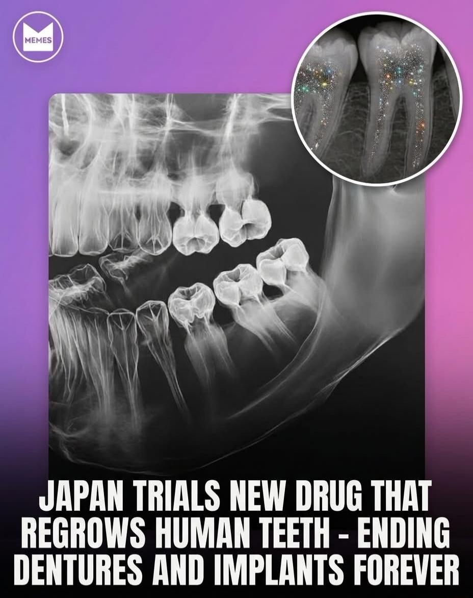 MEMES JAPAN TRIALS NEW DRUG THAT REGROWS HUMAN TEETH - ENDING DENTURES AND IMPLANTS FOREVER