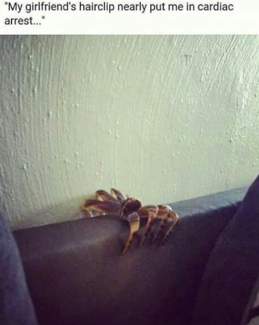 My girlfriends hairclip nearly put me in cardiac arrest D