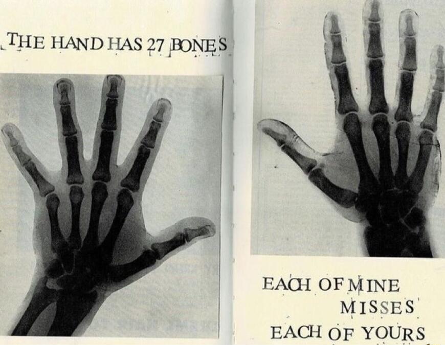 THE HAND HAS 27 BONES EAQH OF MINE MISSES EACH OF YOURS