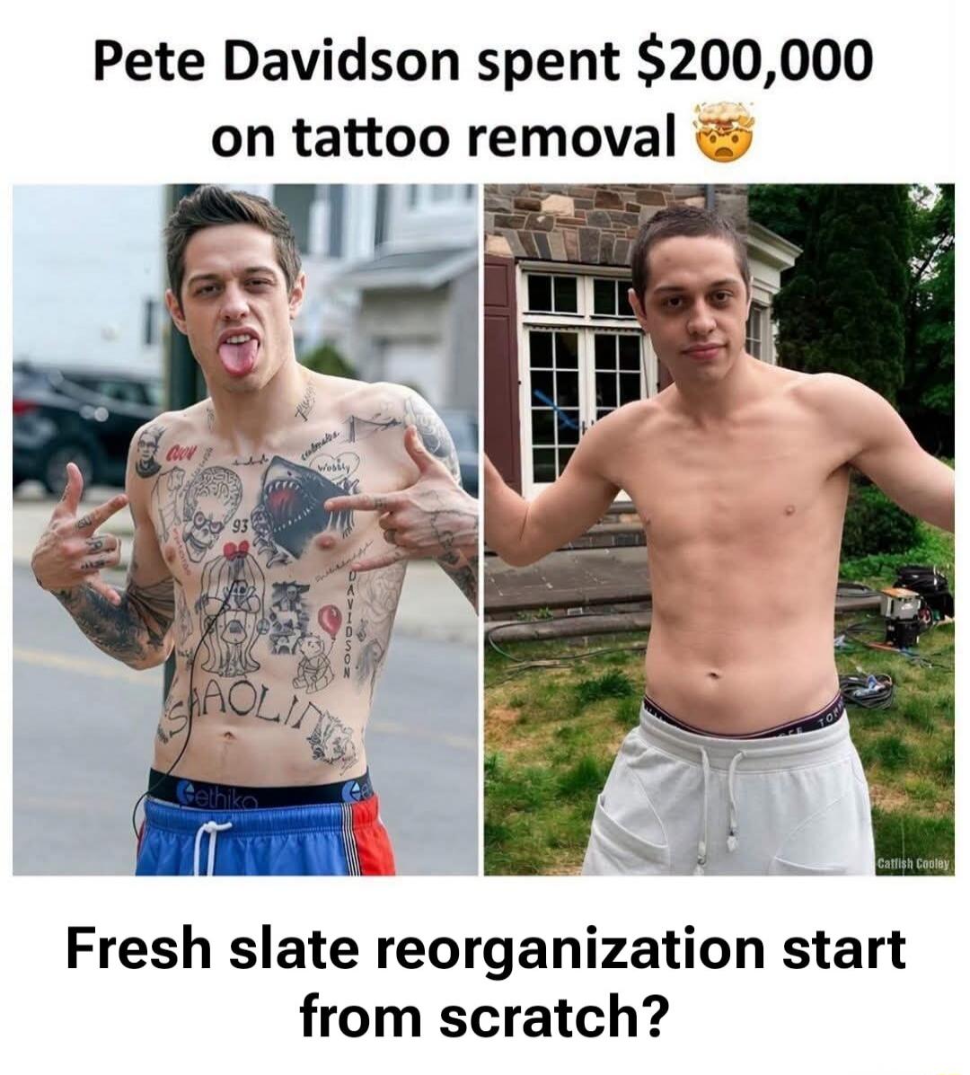 Pete Davidson spent $200,000 on tattoo removal 🤯 Fresh slate reorganization start from scratch?