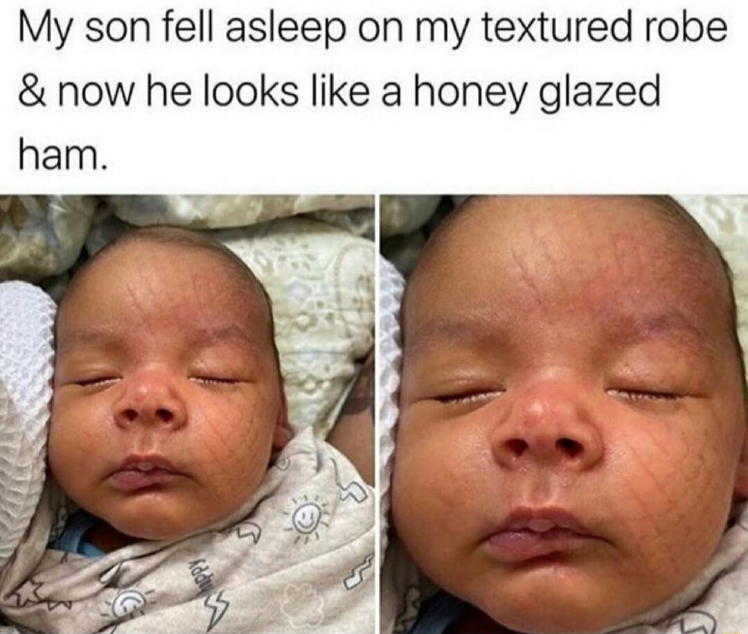 My son fell asleep on my textured robe & now he looks like a honey glazed ham.