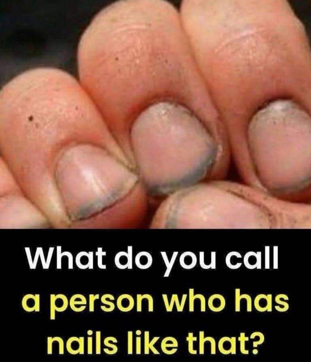 What do you call a person who has nails like that?