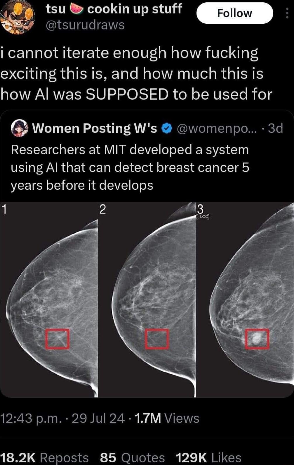 tsu cookin up stuff STEIEIE i cannot iterate enough how fucking exciting this is and how much this is how Al was SUPPOSED to be used for GWomen Posting Ws womenpo 3d Researchers at MIT developed a system using Al that can detect breast cancer 5 years before it develops il 1243 pm 29 Jul 24 17M Views 182K Reposts 85 Quotes 129K Likes