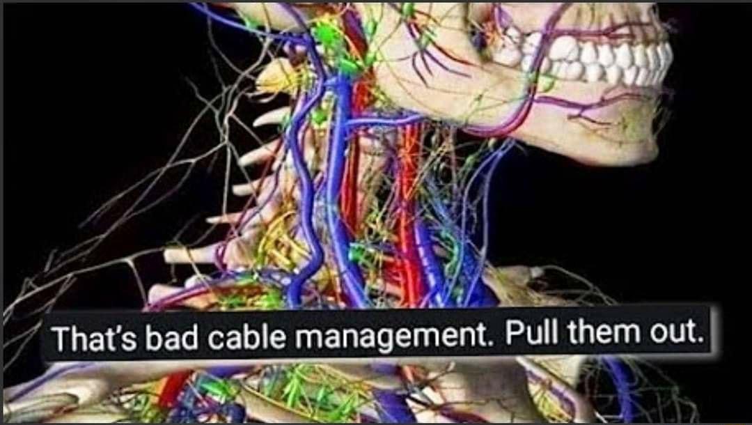 4 h k bad cable management Pull them out