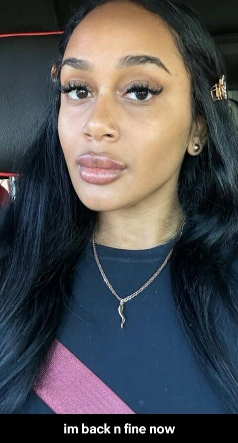 im back n fine now
