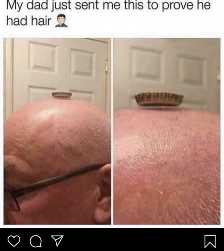 My dad just sent me this to prove he had hair 🤦‍♂️