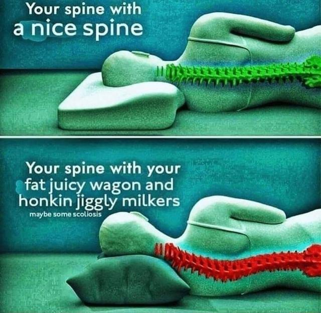 Your spine with anice spine Q Your spine with your L1 VI ANE T i ToTe honkin jiggly milkers maybe some scoliosis