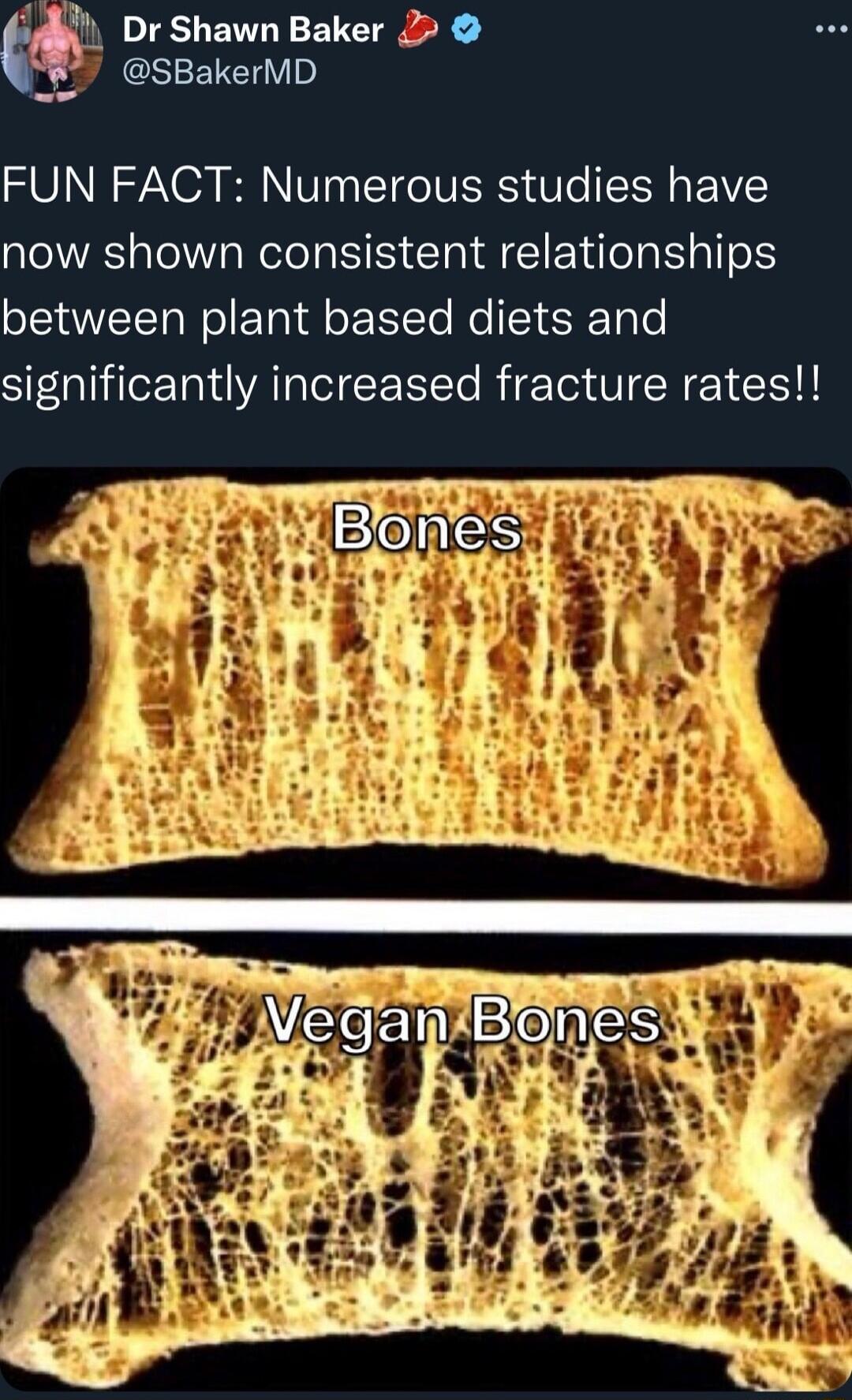 Dr Shawn Baker 2 GSEUEIV o FUN FACT Numerous studies have now shown consistent relationships between plant based diets and significantly increased fracture rates