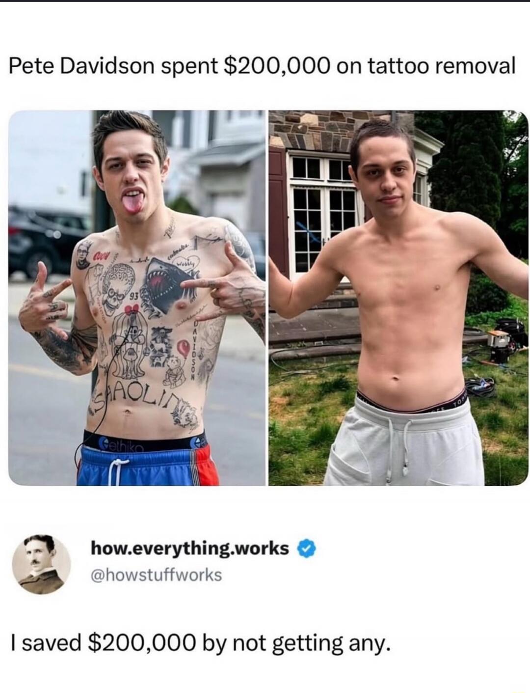 Pete Davidson spent $200,000 on tattoo removal. how.everything.works @howstuffworks. I saved $200,000 by not getting any.