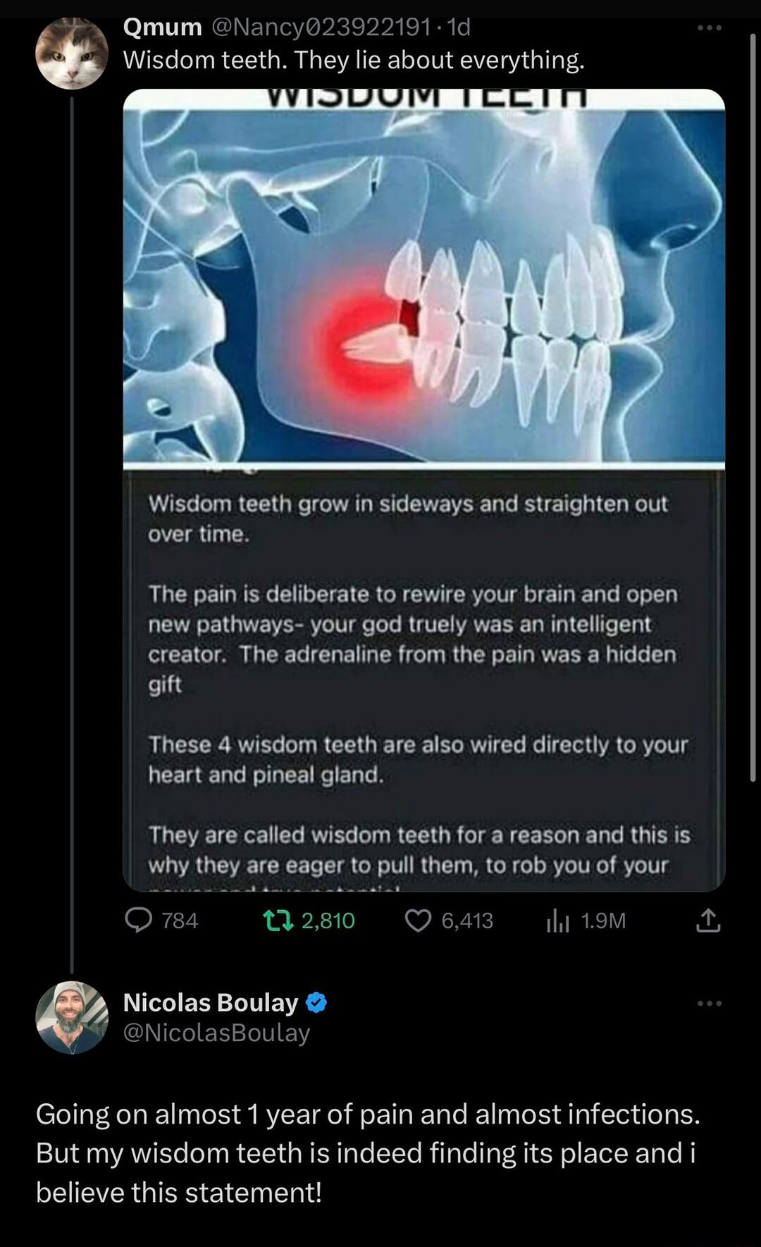 Qmum Nancy023922191 1d Wisdom teeth They lie about everything Wisdom teeth grow in sideways and straighten out over time The pain is deliberate to rewire your brain and open new pathways your god truely was an intelligent creator The adrenaline from the pain was a hidden gift These 4 wisdom teeth are also wired directly to your heart and pineal gland They are called wisdom teeth for a reason and t