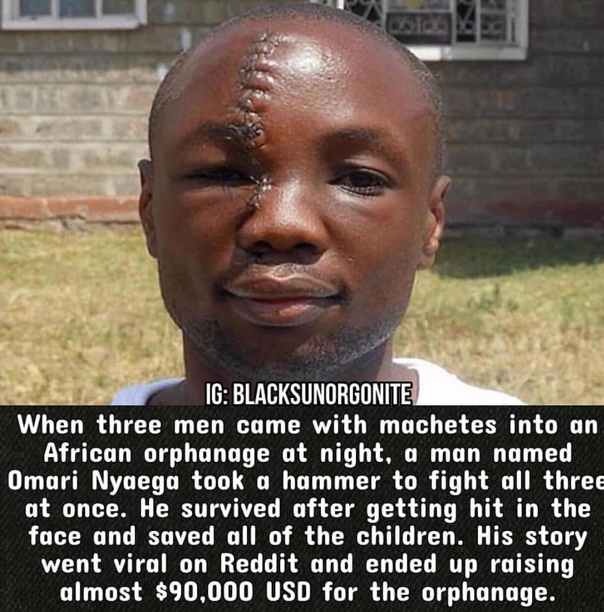 16 BLACKSUNORGONITE When three men came with machetes into an African orphanage at night o man named Omari Nyaega took o hammer to fight all three at once He survived ofter getting hit in the face and saved all of the children His story went viral on Reddit and ended up raising almost 90000 USD for the orphanage