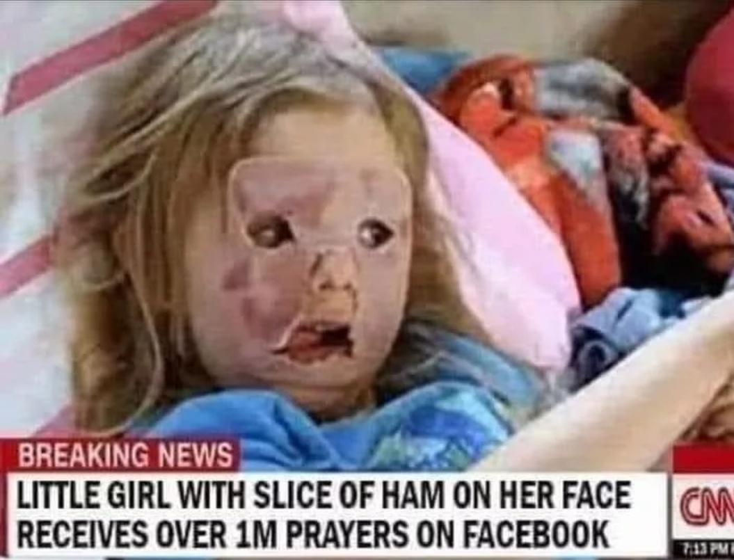 LITTLE GIRL WITH SLICE OF MAM ON HER FACE W RECEIVES OVER 1M PRAYERS ON FACEBOOK