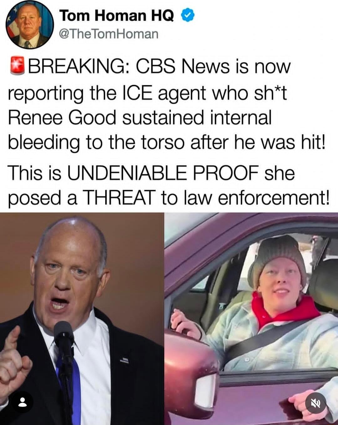 🔴 BREAKING: CBS News is now reporting the ICE agent who sh*t Renee Good sustained internal bleeding to the torso after he was hit! This is UNDENIABlE PROOF she posed a THREAT to law enforcement!