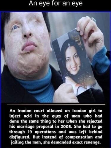 An eye for an eye An Iranian court allowed an Iranian girl to inject acid in the eyes of man who had done the same thing to her when she rejected his marriage proposal in 2005 She had to go through 19 operations and was left behind disfigured But instead of compensation and jailing the man she demanded exact revenge