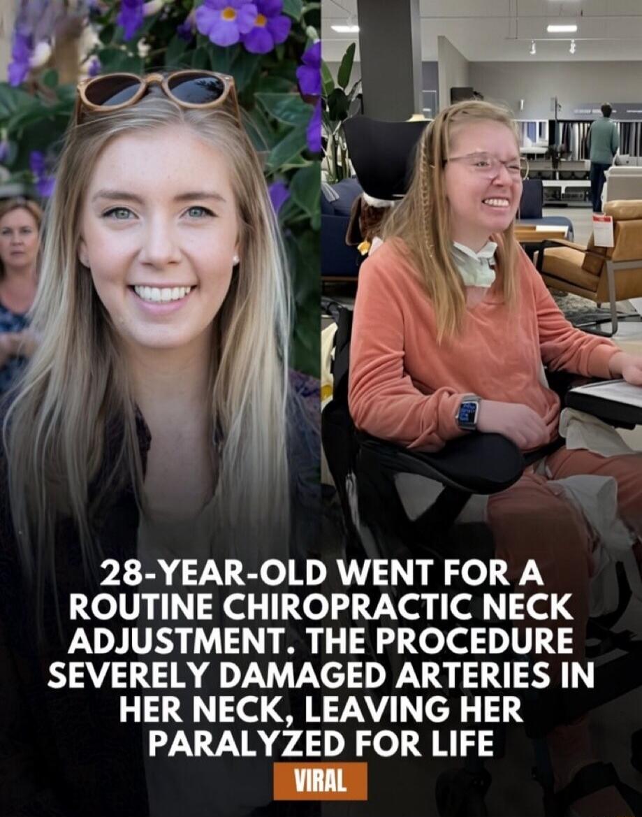 28-YEAR-OLD WENT FOR A ROUTINE CHIROPRACTIC NECK ADJUSTMENT. THE PROCEDURE SEVERELY DAMAGED ARTERIES IN HER NECK, LEAVING HER PARALYZED FOR LIFE. VIRAL