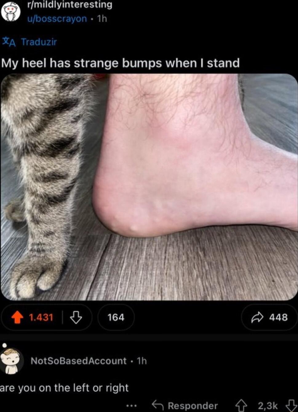 rimildlyinteresting 1 My heel has strange bumps when stand 1 164 448 NotSoBasedAccount 1t are you on the left or right Responder