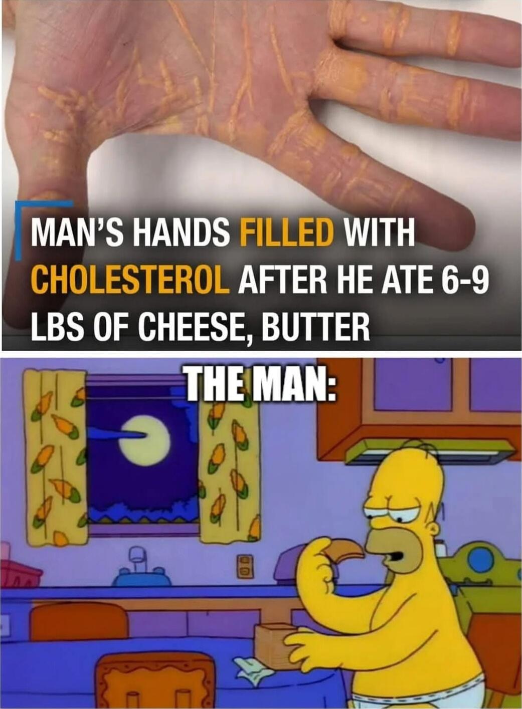 CHOLESTEROL AFTER HE ATE 6 9 LBS OF CHEESE BUTTER