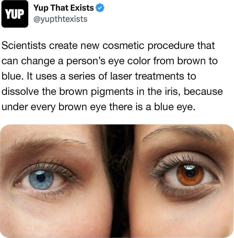 Yup That Exists yupthtexists Scientists create new cosmetic procedure that can change a persons eye color from brown to blue It uses a series of laser treatments to dissolve the brown pigments in the iris because under every brown eye there is a blue eye