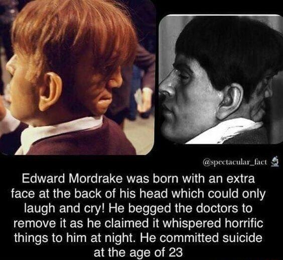 spectacular_fact Edward Mordrake was born with an extra face at the back of his head which could only laugh and cry He begged the doctors to remove it as he claimed it whispered horrific things to him at night He committed suicide at the age of 23