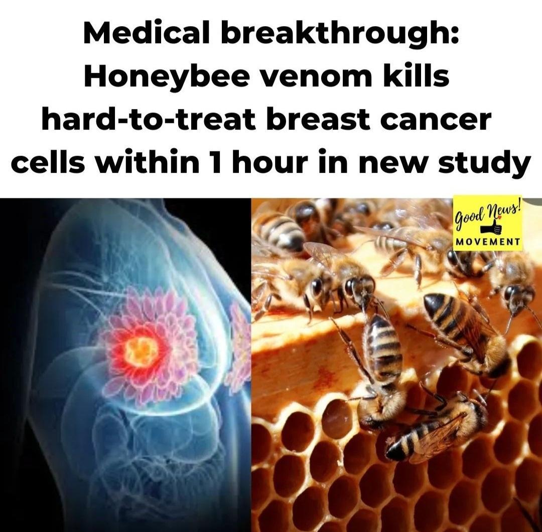 Medical breakthrough Honeybee venom kills hard to treat breast cancer cells within 1 hour in new study