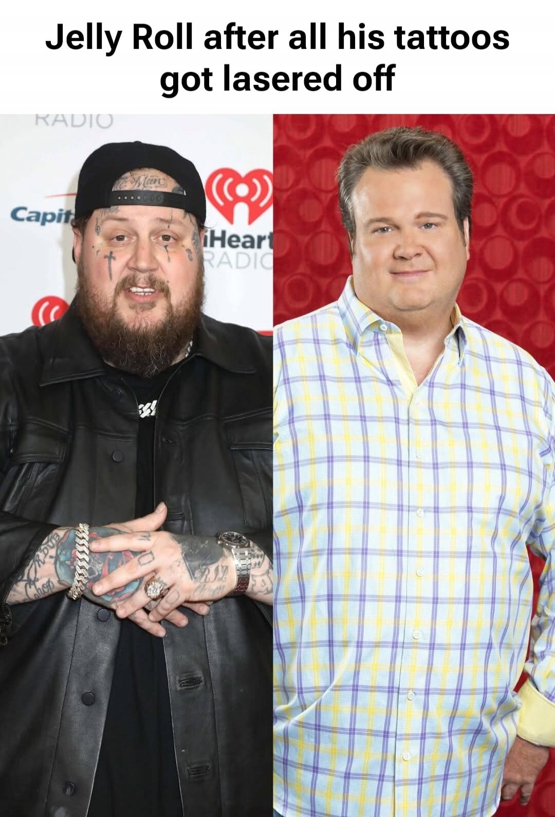 Jelly Roll after all his tattoos got lasered off