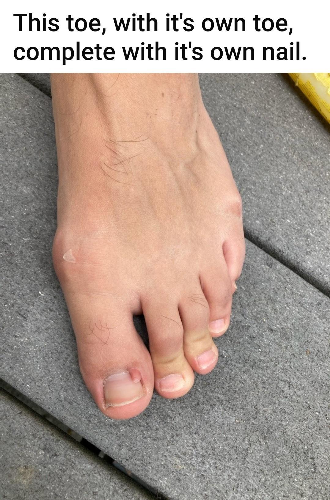 This toe with its own toe complete with its own nail