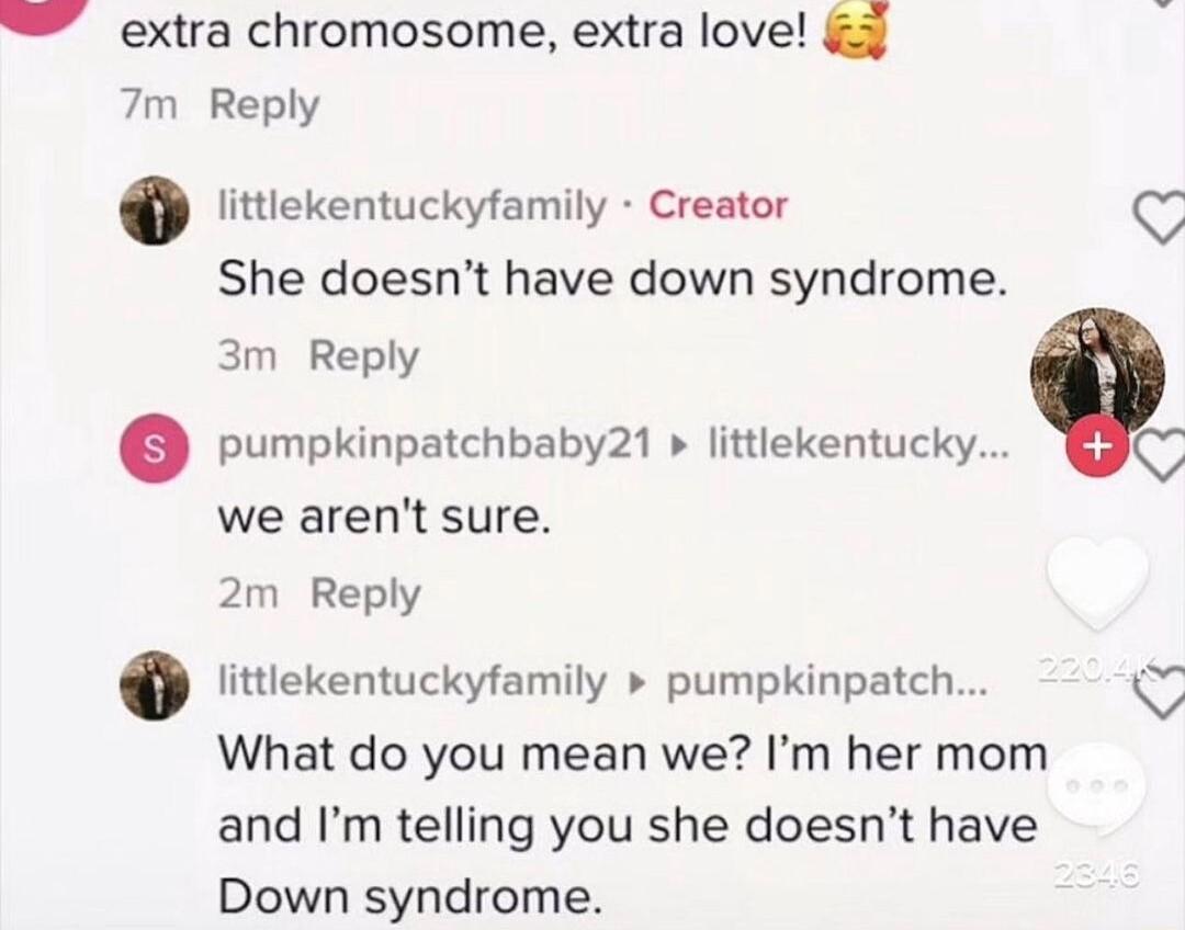 extra chromosome extra love 5 7m Reply littlekentuckyfamily Creator She doesnt have down syndrome 3m Reply pumpkinpatchbaby21 littlekentucky we arent sure 2m Reply littlekentuckyfamily pumpkinpatch K What do you mean we Im her mom and Im telling you she doesnt have Down syndrome