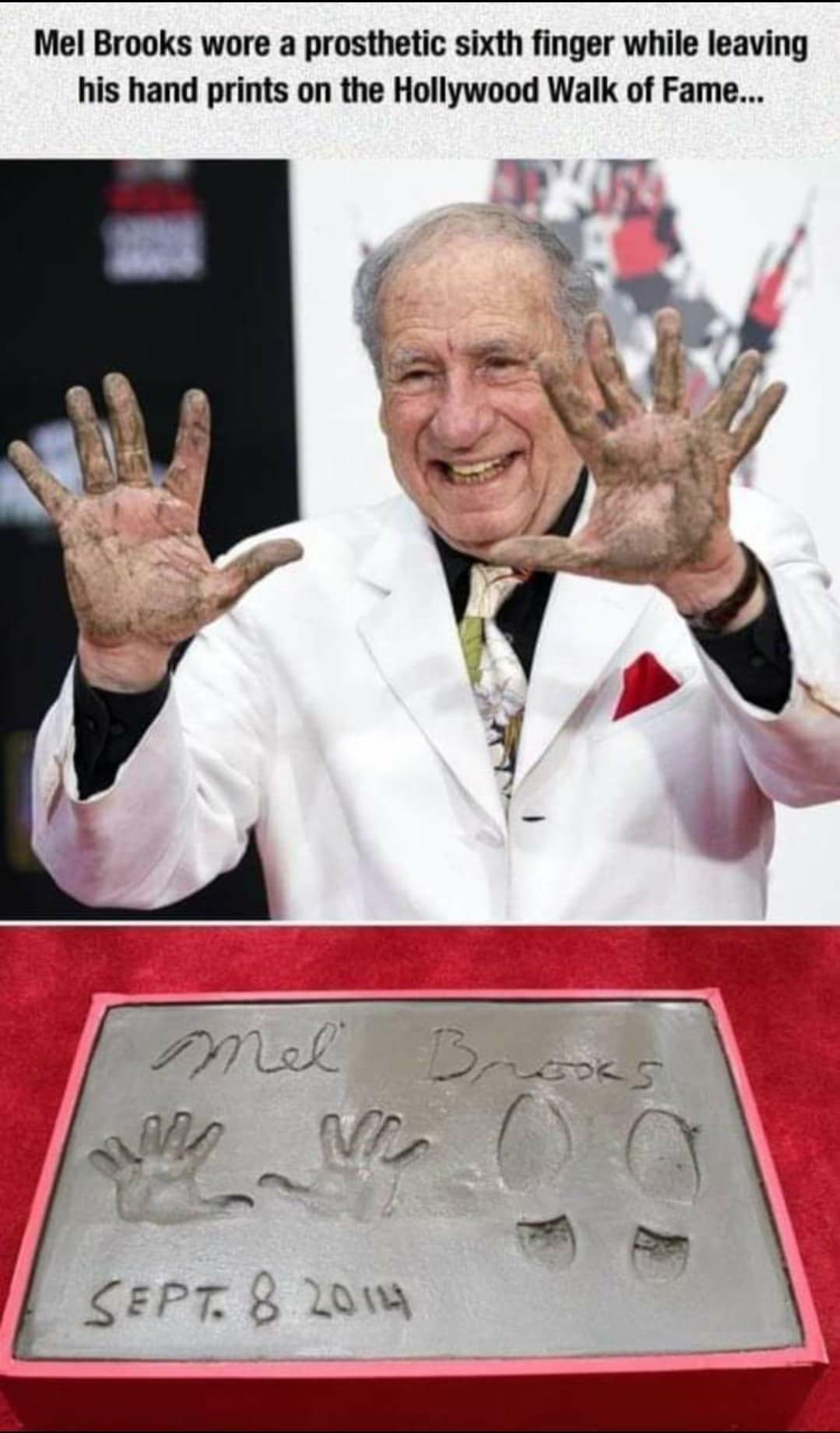 Mel Brooks wore a prosthetic sixth finger while leaving his hand prints on the Hollywood Walk of Fame