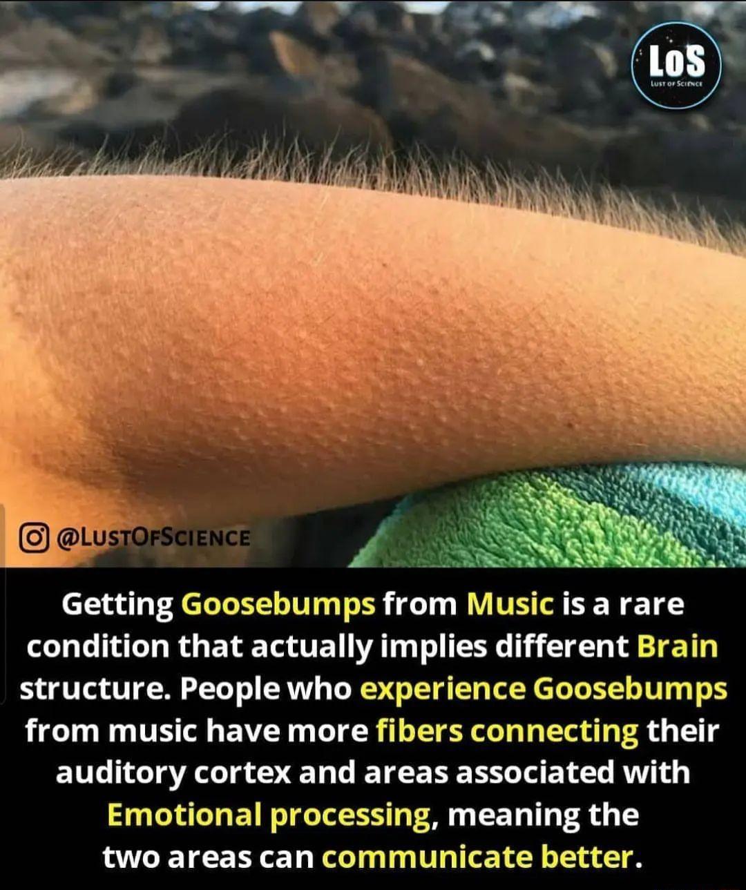 Getting Goosebumps from Musicis a rare LT TG RGETE T TET AT T NG 1 10 T TET structure People who experience Goosebumps from music have more fibers connecting their EUL GG E R ETEEDE LT ET L R Emotional processing meaning the LUCETEERLED T T ITILET Y
