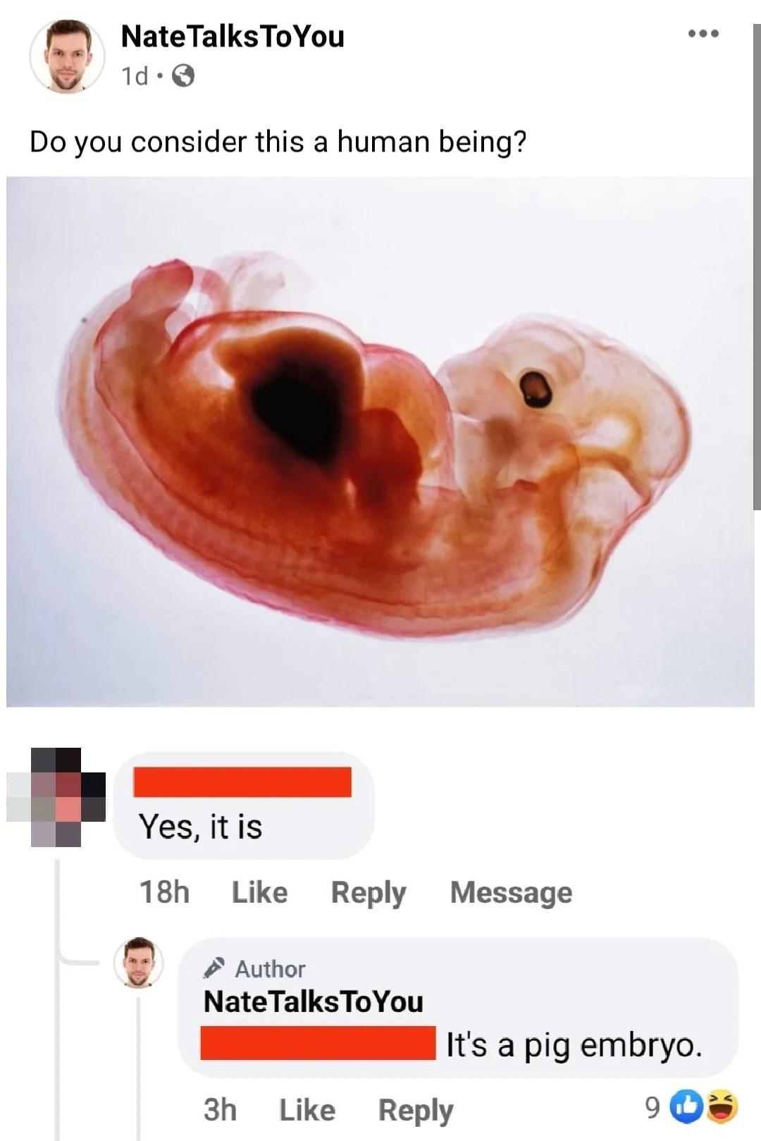 NateTalksToYou 1d Q Do you consider this a human being Yes itis 18h Like Reply Message Author NateTalksToYou N 1ts a pig embryo 3h Like Reply Qs